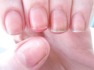 مخاطر طلاء الأظافر