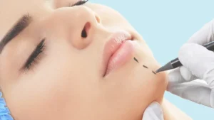 عمليات التجميل