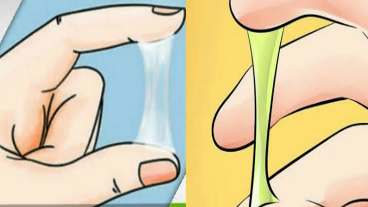 الإفرازات البيضاء