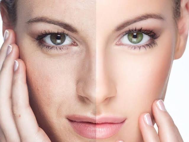 افضل كريم لتفتيح البشرة السمراء