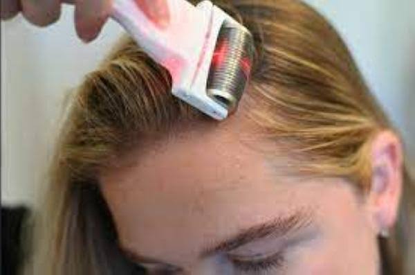 فوائد الديرما رولر للشعر