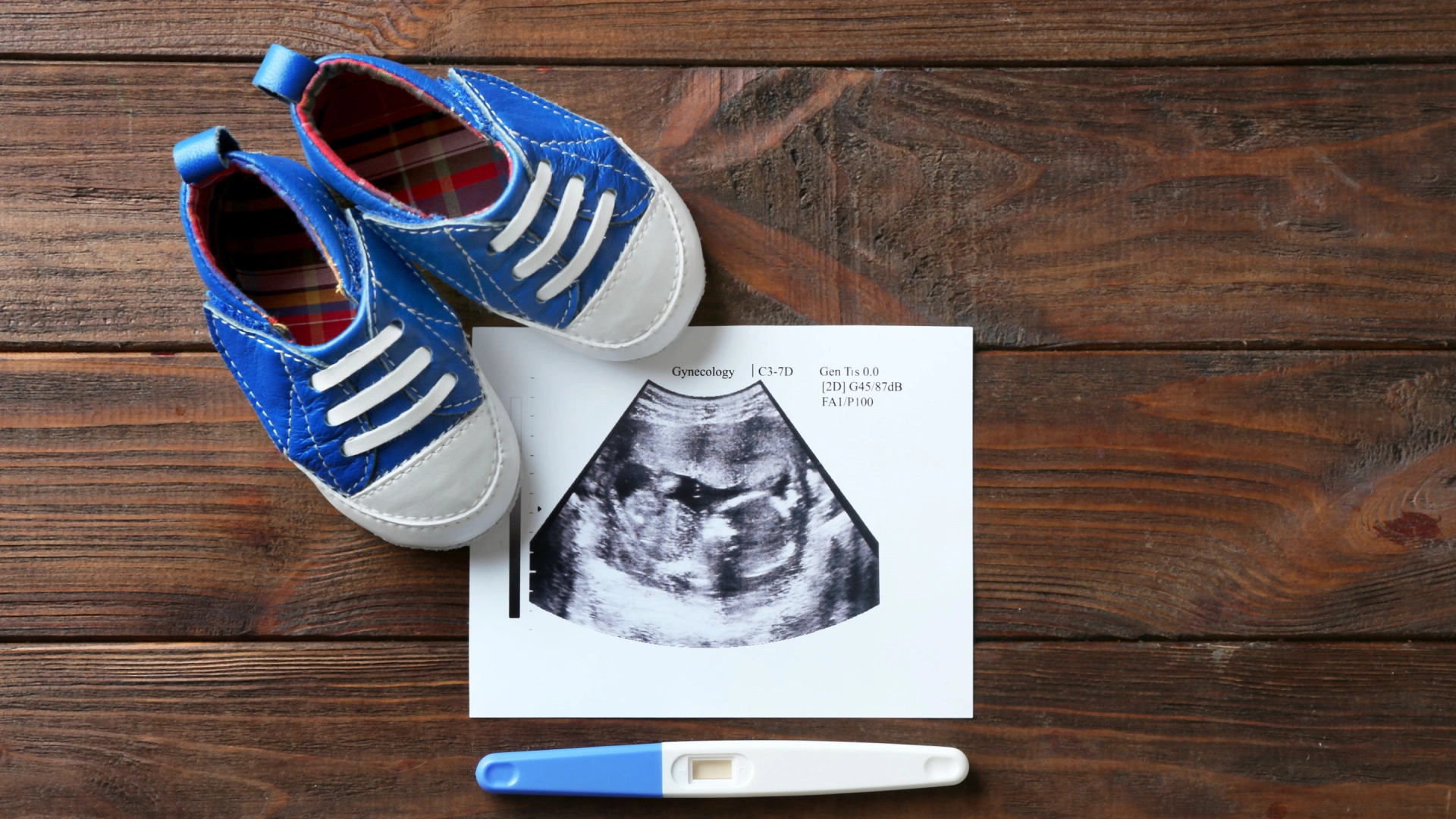 اعراض الحمل بولد