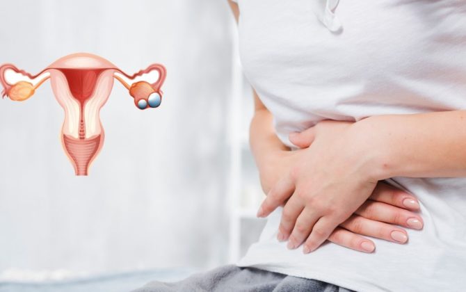 علاج تكيسات المبايض