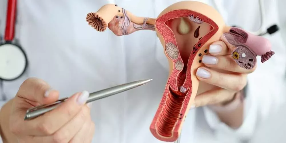 علاج تكيسات المبايض