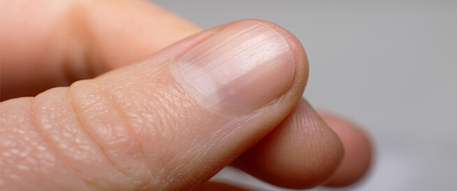 ما هي أعراض نقص الكالسيوم