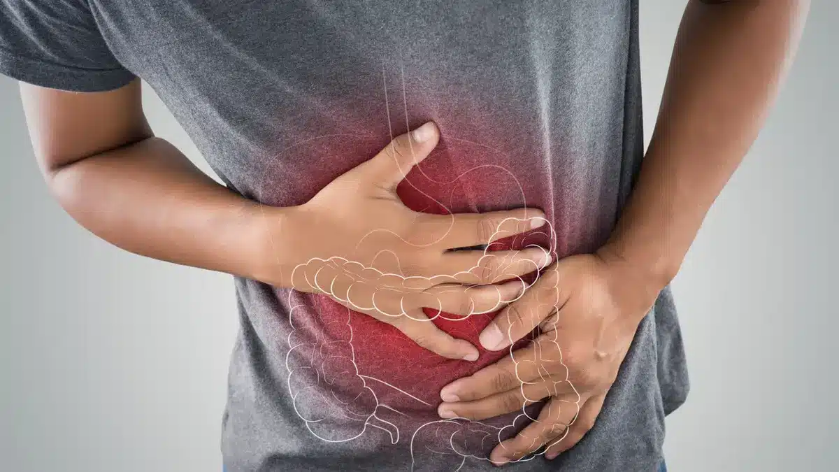 وصفات لعلاج الامساك