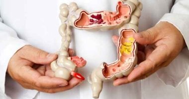 القولون العصبي