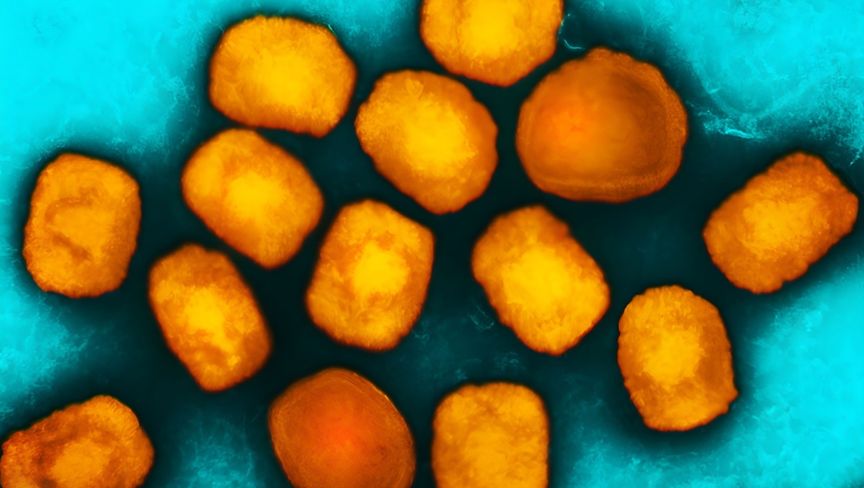 اعراض جدري القرود