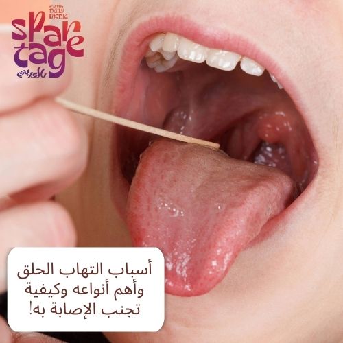 أسباب التهاب الحلق وأهم أنواعه وكيفية تجنب الإصابة به!