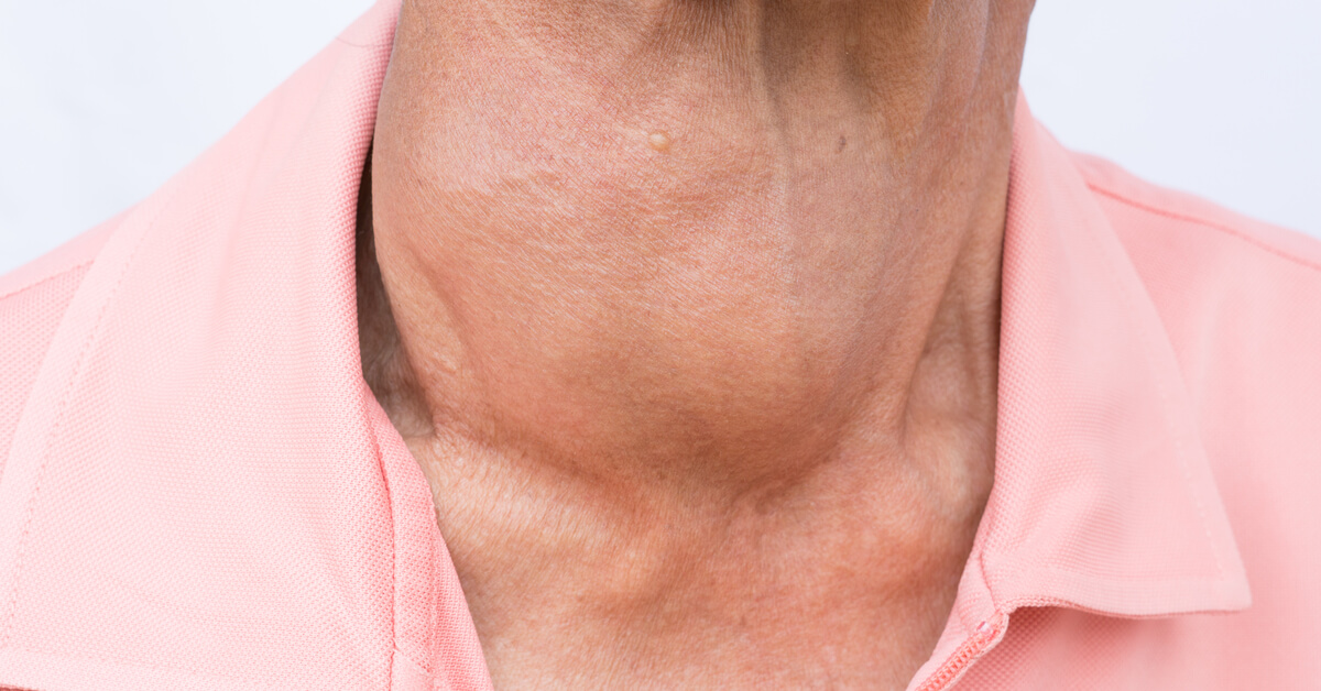 ارتفاع غدة الدرقية