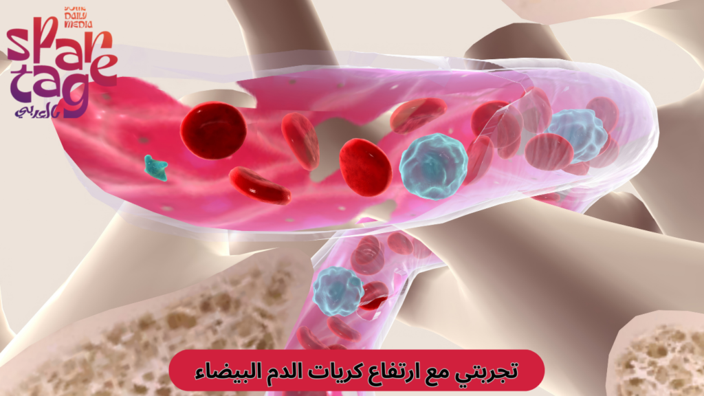 ارتفاع عدد كريات الدم البيضاء