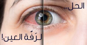 سبب رفة العين اليمنى
