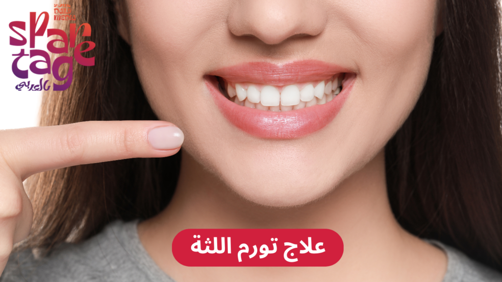 اسباب تورم اللثة