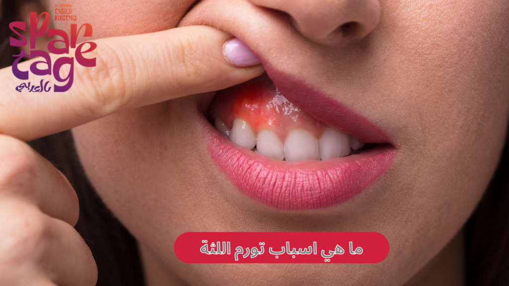 اسباب تورم اللثة