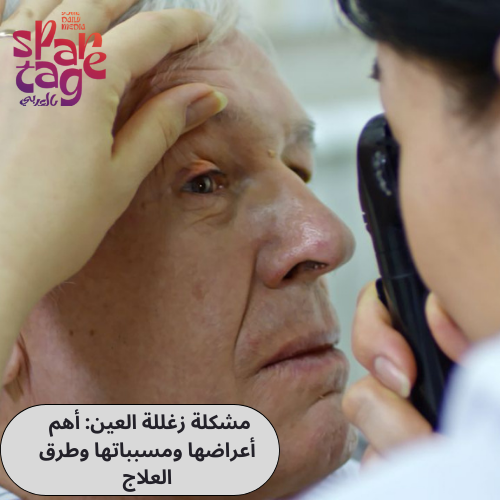مشكلة زغللة العين أهم أعراضها ومسبباتها وطرق العلاج