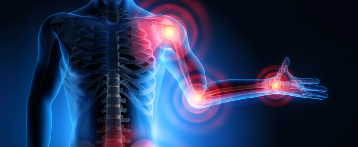 أكثر مناطق الجسم عرضة للإصابة بالنقرس