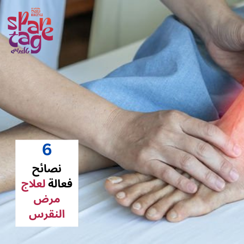 أهم 6 نصائح فعالة لعلاج مرض النقرس