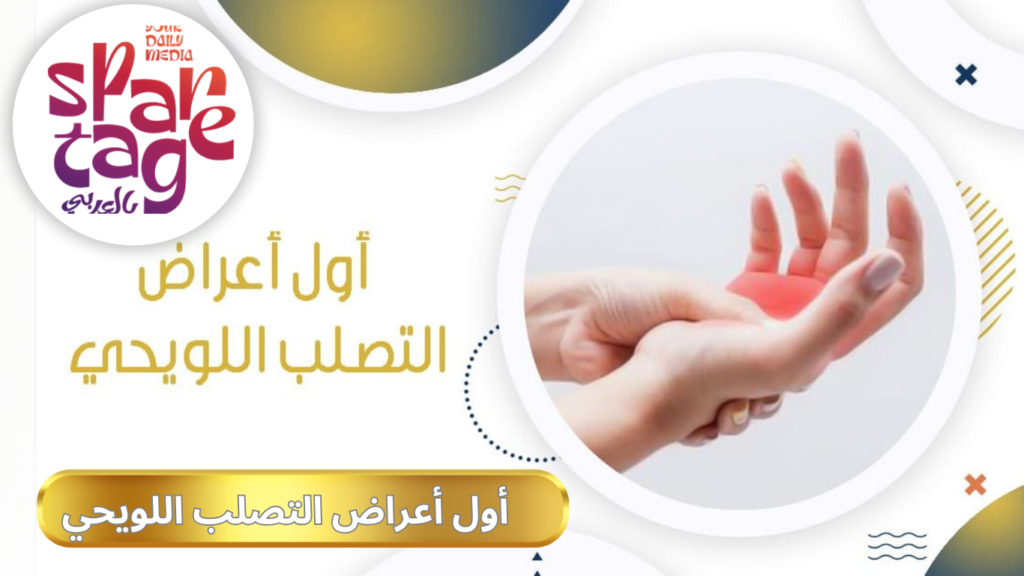 ما هو مرض التصلب اللويحي 