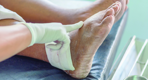 المتخصصون في علاج النقرص