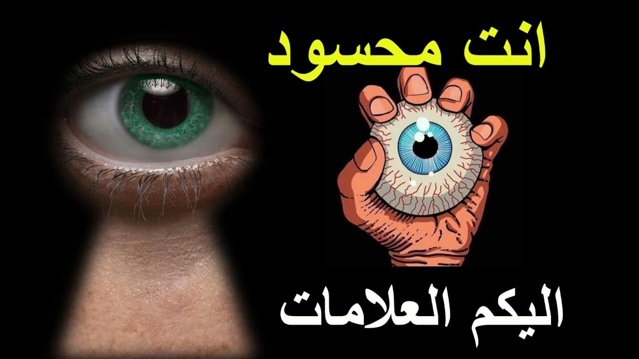 علامات الحسد