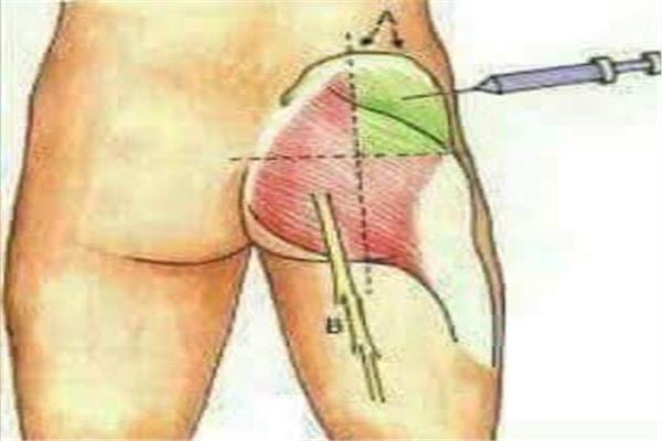 متى تظهر اعراض الحقن الخاطئ في العضل