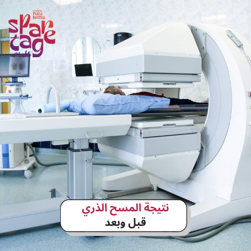 نتيجة المسح الذري قبل وبعد