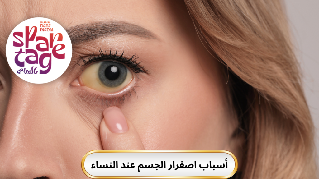 مرض الصفراء الجلدي
