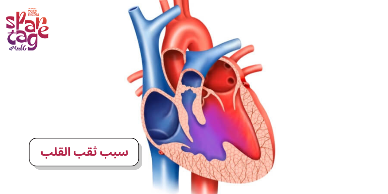 سبب ثقب القلب