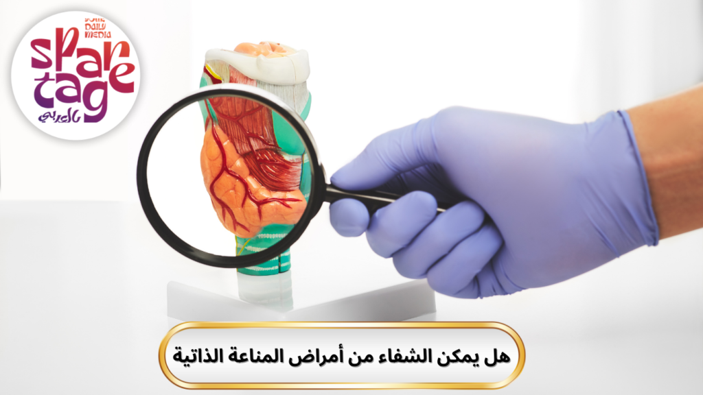 امراض المناعة الذاتية