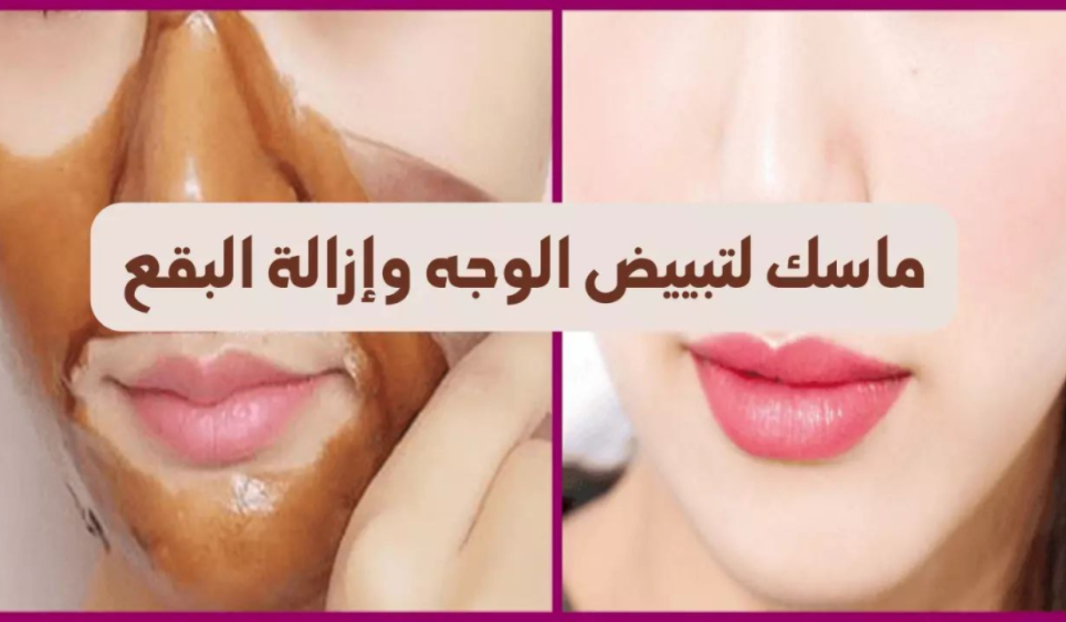 إزالة البقع من الوجه في يومين