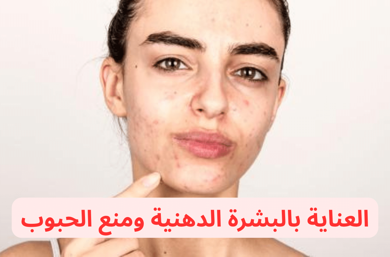 العناية بالبشرة الدهنية ومنع الحبوب