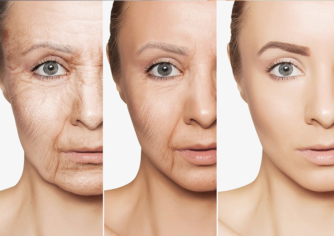 حقائق وخرافات حول (البوتوكس): ماتحتاج معرفته قبل القرار