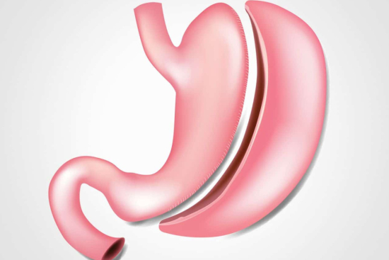 تكلفة عملية تكميم المعدة في أفضل المستشفيات