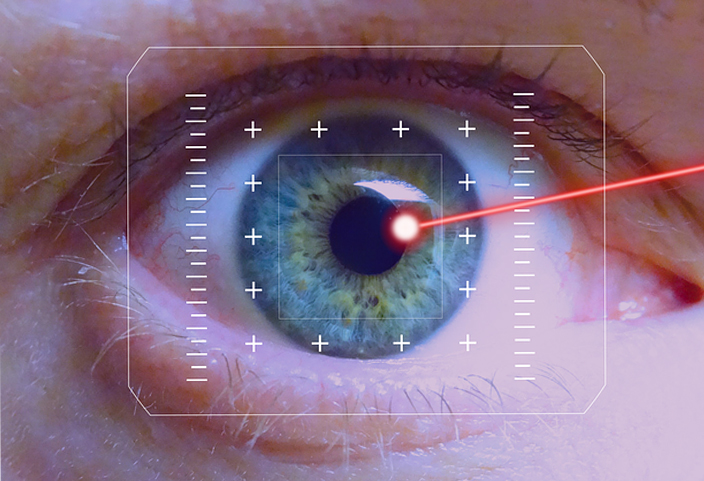 تكلفة عمليات تصحيح النظر بالليزر