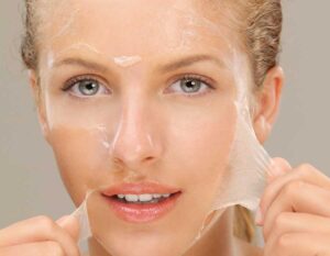 تقشير البشرة الكيميائي: الفوائد والمخاطر